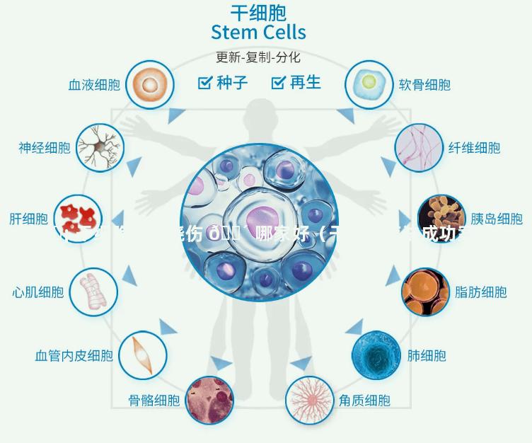 🐡 干细胞治疗烧伤 🐴 哪家好（干细胞疗法成功案例）